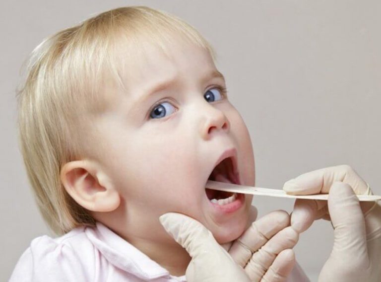 bogaz-agrisi bogaz-agrisi